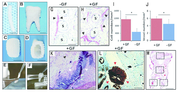  Design and fabrication of anatomically shaped human and rat tooth scaffolds by 3D bioprinting.