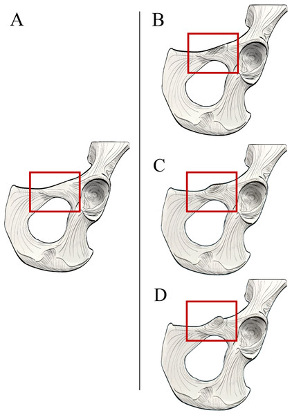 Illustrated character states for Character 1 (Iliopectineal tubercle presence).