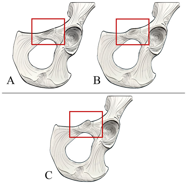 Illustrated character states for Character 2 (Iliopectineal tubercle size).