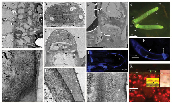 Photographs of micro- and ultra-structure and histochemistry of B. schreberi glandular trichomes.