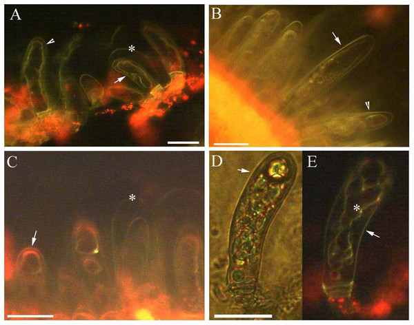 Photomicrographs of autofluorescence under blue excitation of B. schreberi glandular trichomes in vivo.
