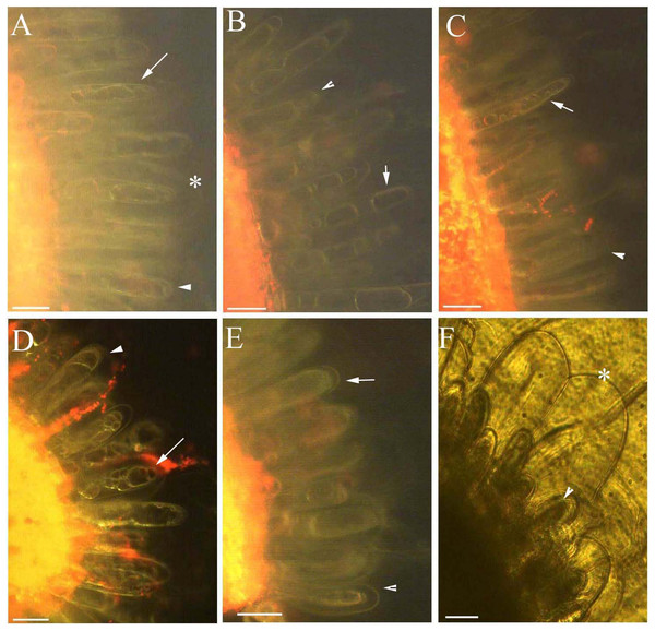 Photomicrographs of autofluorescence under blue excitation of B. schreberi glandular trichomes stressed by NaCl solutions in vivo.
