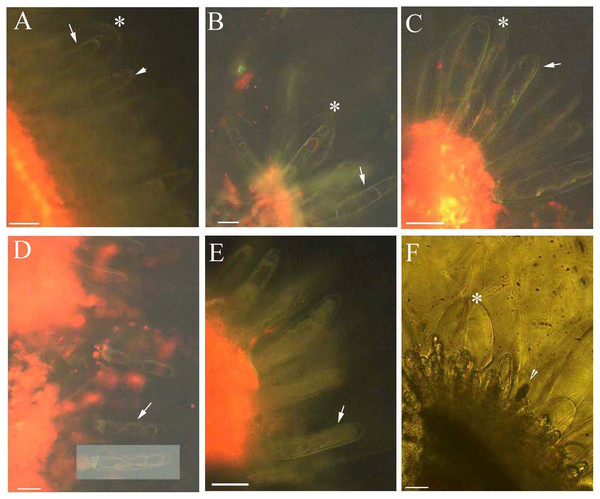 Photomicrographs of autofluorescence under blue excitation of B. schreberi glandular trichomes stressed by ethanol in vivo.