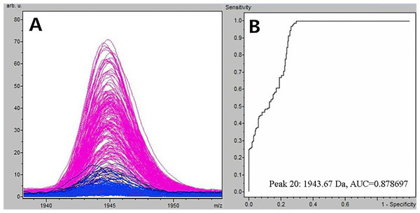 Comparison of m/z 1,945.07 expression level between schizophrenia patients and healthy controls.