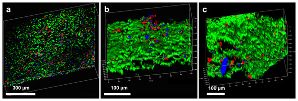 Endothelial cell integration into hybrid grafts.