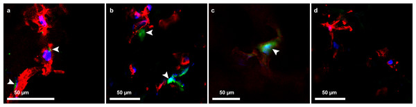 AAV-GFP transduction of endothelial cells.