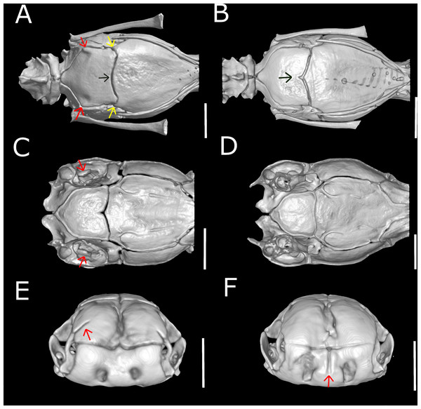 Three-dimensional reconstruction of skulls of different specimens of Epictia rioignis sp. nov. based on Micro-CT data, showing variations in skull parameters.