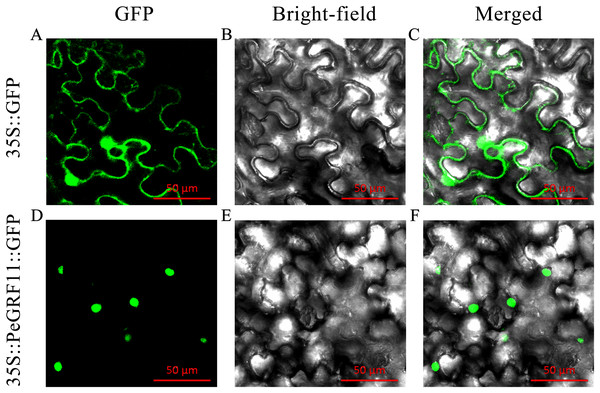 Subcellular localization of PeGRF11 in tobacco leaves.