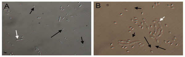 Differential Interference Contrast micrographs of Bacillus thuringiensis strains showing different morphologies of insecticidal crystal proteins (ICPs).