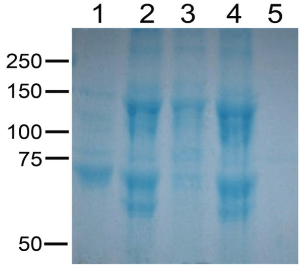 Electrophoretic pattern of solubilized crystal protein fractions from selected strains of Bacillus thuringiensis.