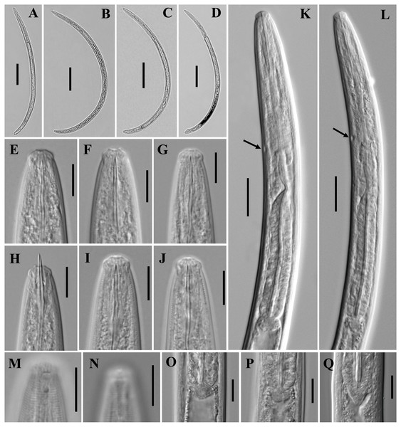 Microphotographs of Paratylencholaimus shanshaensis gen. nov. sp. nov.