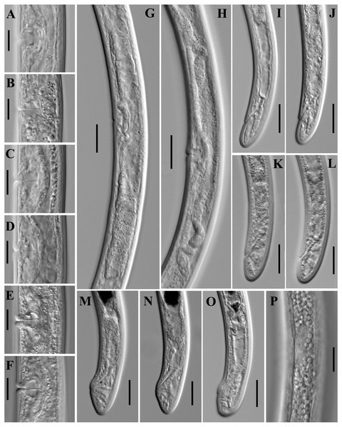 Microphotographs of Paratylencholaimus shanshaensis gen. nov. sp. nov.