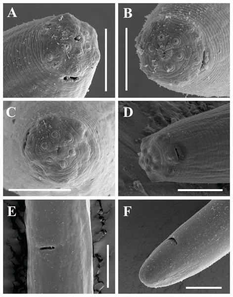Scanning electron micrographs of Paratylencholaimus shanshaensis gen. nov. sp. nov.
