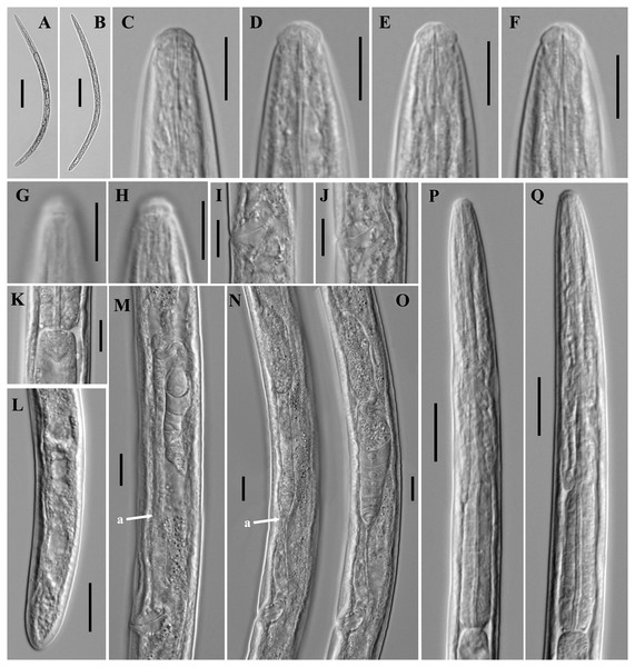 Microphotographs of Tylencholaimus zhongshanensis sp. nov.