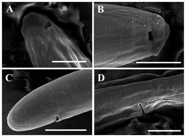 Scanning electron micrographs of  Tylencholaimus zhongshanensis sp. nov.