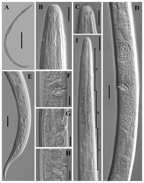 Microphotographs of Dorylaimoides shapotouensis sp. nov.