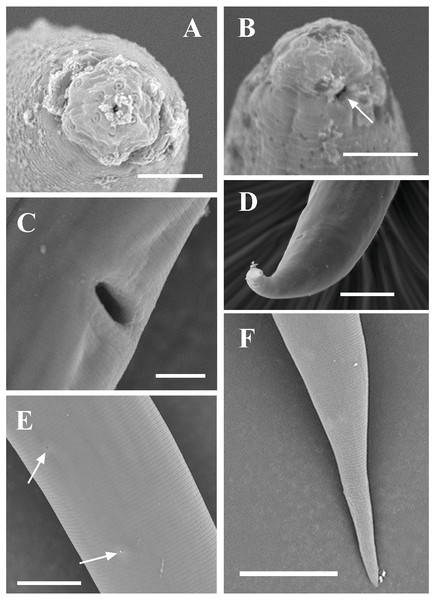 Scanning electron micrographs of Dorylaimoides shapotouensis sp. nov.