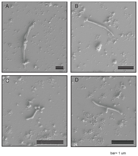 SEM images of WSS reveal non-helical Spiroplasma-like morphotype.