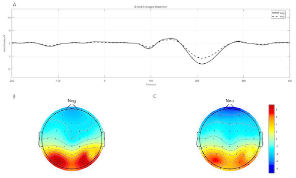  P1 component elicited under neutral and negative conditions at electrode sites PO3, PO4, PO7, PO8, POz, O1, O2, Oz and Brain topography of P1.