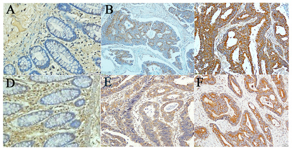 Results from Immunohistochemical (IHC) staining.