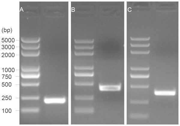 1.5% gel electrophoresis results of amplification products.