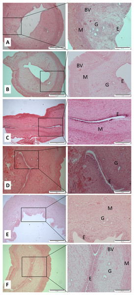 Cross sections of the uterus (Magnification 4× with scale bar: 500 μm and 10× with scale bar: 200 μm) of (A) Control (C), (B) H (honey), (C) 20E (20 jumps/day), (D) 80E (80 jumps/day), (E) 20EH (20 jumps and honey supplementation), (F) 80EH (80 jumps and honey supplementation).