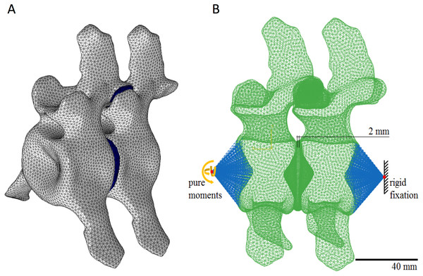 Finite element model with a dorsal intervertebral disk length of 2 mm.