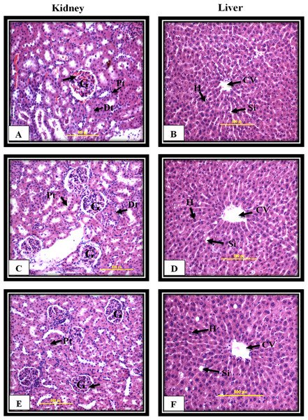 Kidney and liver histological analysis of the acute toxicity experiment.
