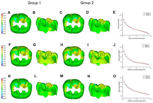 Stress distributions (MPa) in enamel, and stress values in specified path between Group 1 and Group 2.