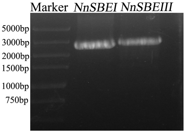 The amplication of cDNA fragments of NnSBEs.