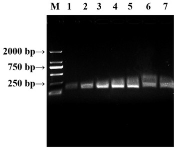 qPCR and loop mediated isothermal amplification for rapid detection of ...