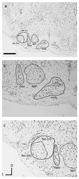 The superior olivary complex (SOC) nuclei in the fat-tailed dunnart.