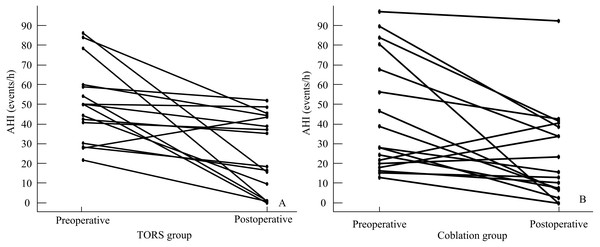 Individual AHI decrease in TORS (A) and Coblation (B) groups.