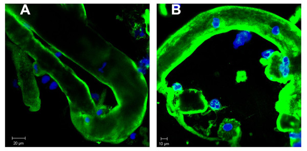 Immunofluorescence staining of renal tubular casts. Various staining intensity for lambda light chain of tubular casts.