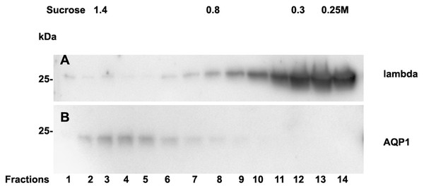 Sucrose density gradient separation of urine of patient 14 containing cast fragments, exosomes and micro-aggregates.