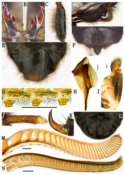 Labriocimbex sinicus Yan & Wei, gen. et sp. nov.