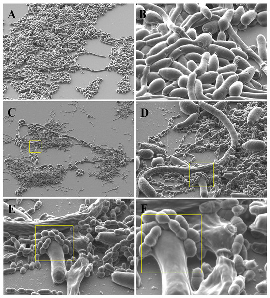 Binding and coaggregation of S. gordonii and C. albicans in early biofilms.