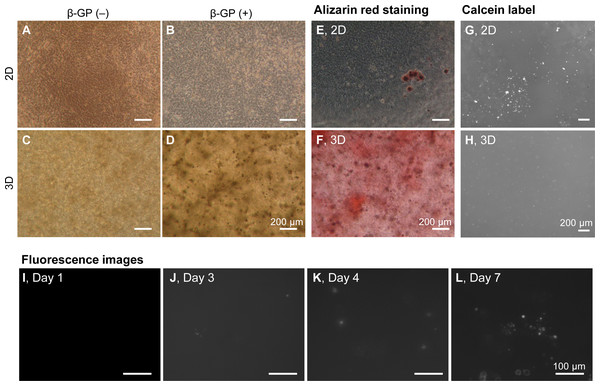 Mineralization of HOS cells in a 3D collagen gel.