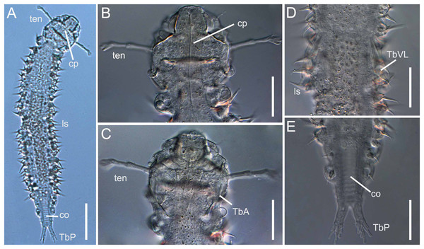 Xenodasys sp., DIC images from Brazil