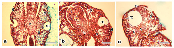 Anatomical structure of current year’s leaf of P. orientalis trees of different ages.