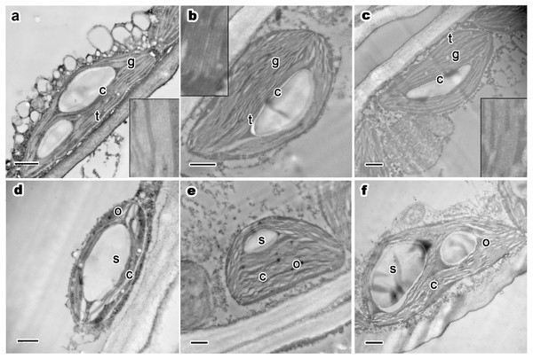 Ultrastructure of current year’s leaf’s chloroplast, osmiophilic granules and starch grains of P. orientalis tree at different tree ages.