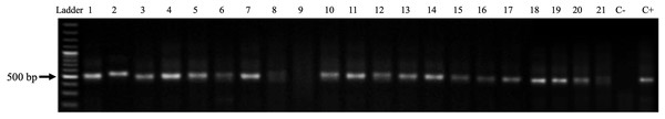 Amplification of the GAPDH enzyme gene from genomic DNA obtained from biopsies of CTVT.