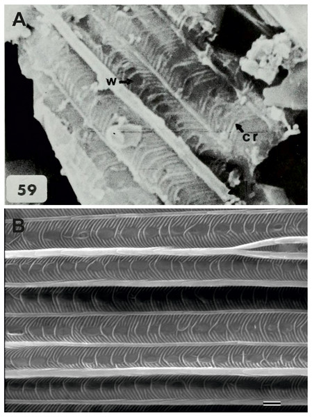 Scanning electron microscope images of Prohepialus sp. identified by Jarzembowski (1980) and Sthenopis argenteomaculatus (Harris).