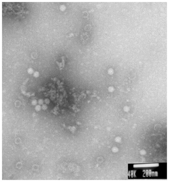 CSBV particles were observed with electron microscopy.