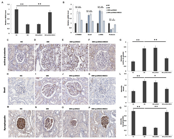 MEG3 improved renal function in diabetic rats.