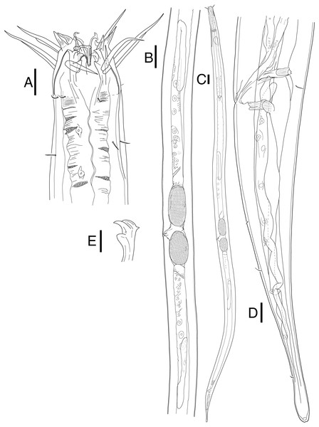 Mesacanthion jejuensis. sp. nov. female.