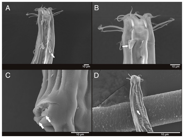 Scanning electron micrograph of Mesacanthion jejuensis sp. nov.