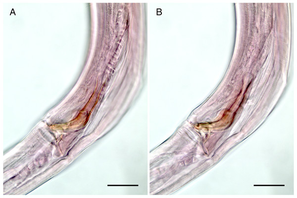 Mesacanthion jejuensis sp. nov. (A and B, paratype).