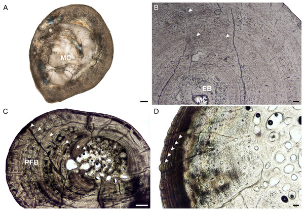 Radial osteohistology of Stigmochelys pardalis.