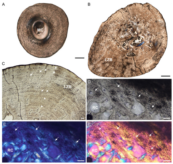 Fibula osteohistology of Stigmochelys pardalis.